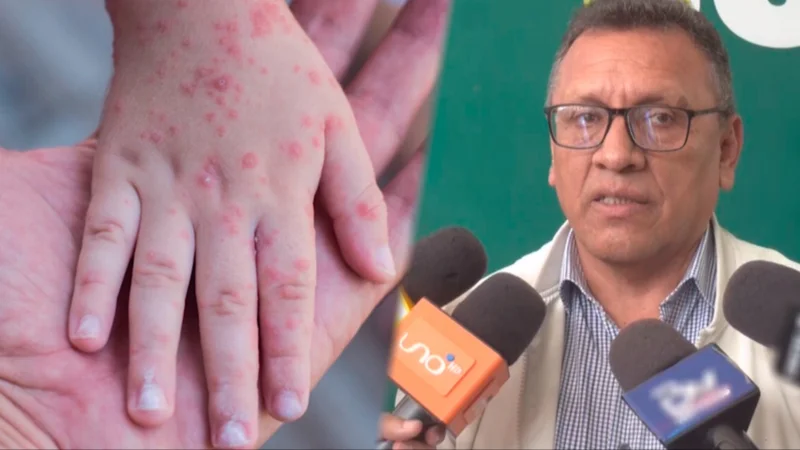 El viceministro de Promoción, Vigilancia Epidemiológica y Medicina Tradicional, Max Enríquez Nava. FOTO: NTV/RED UNO. Composición CHMF.
