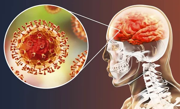 Reportan posible segundo caso de meningitis en Santa Cruz en un menor ...